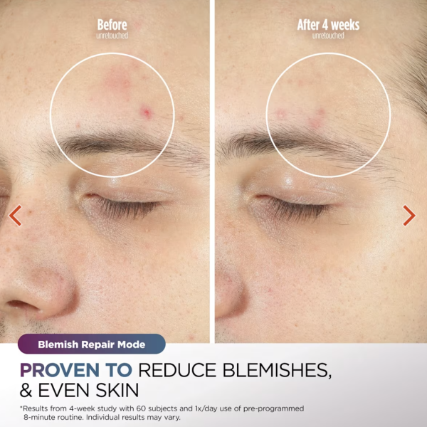 Shark CryoGlow LED Mask Competition